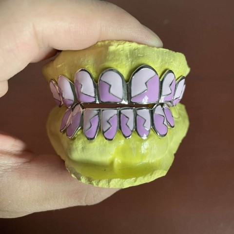 Moissanite Iced Out Teeth Grillz Sterling Silver Custom Hip Hop Jewelry