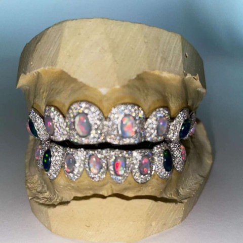 Moissanite Iced Out Teeth Grillz Sterling Silver Custom Hip Hop Jewelry